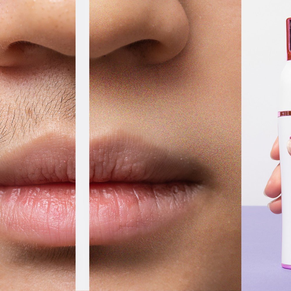 Nuve™ Epil Pro - Nuve